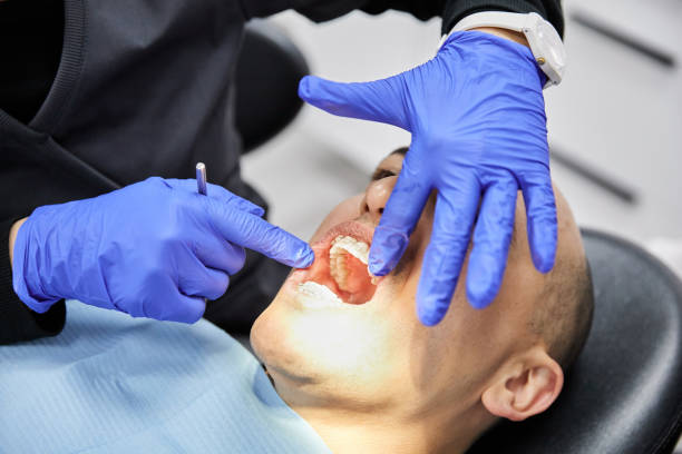 Best Emergency Gum Treatment in Horse Cave, KY